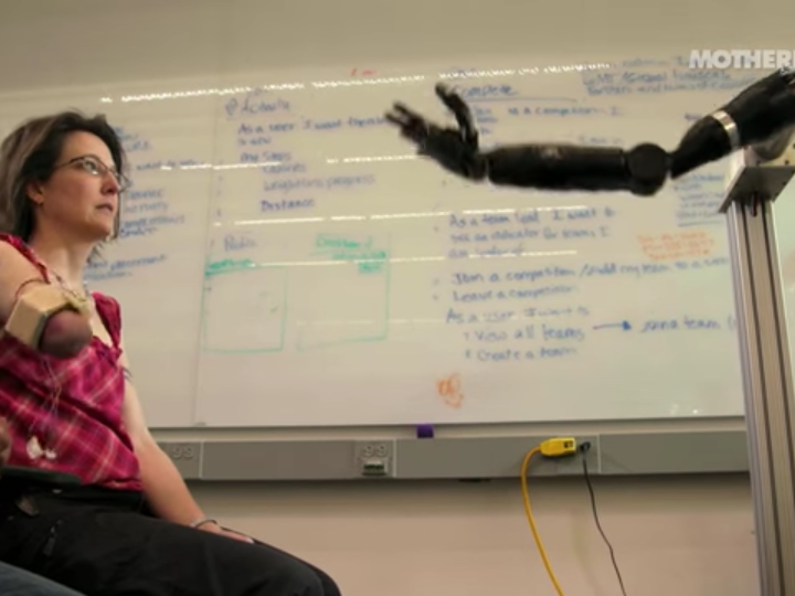 This Mind-Controlled Bionic Arm Can Touch and Feel.